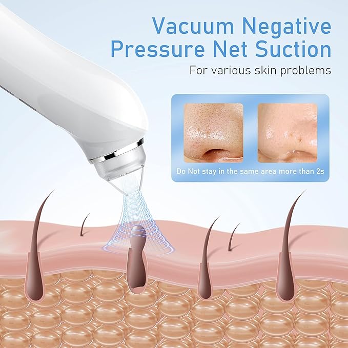 Facial Pore Blackhead Remover Vacuum, 1080P Camera Blackhead Remover, 20x Zoom - Image 5