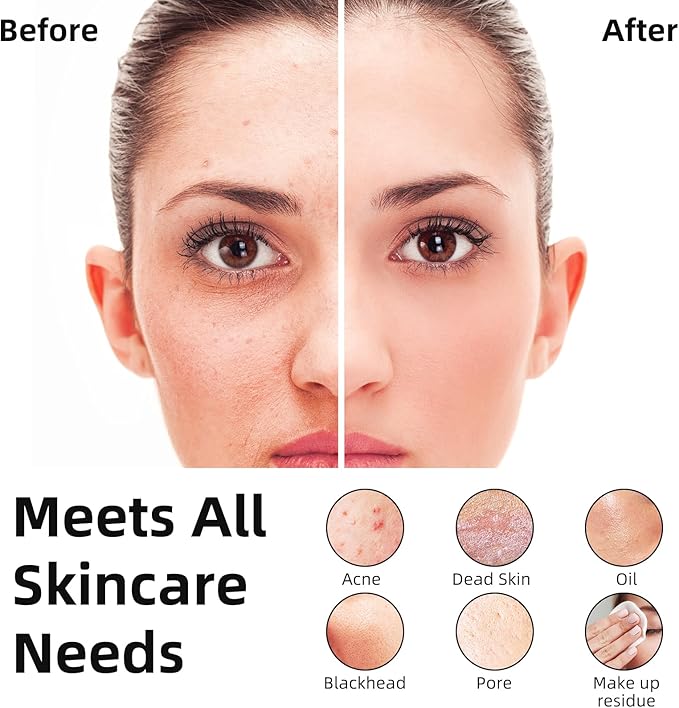 Facial Cleansing Brush Portable Waterproof Rechargeable Face Wash Brush - Image 3