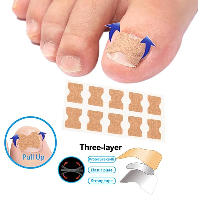 Ingrown Toenail Corrector Set - Image 3