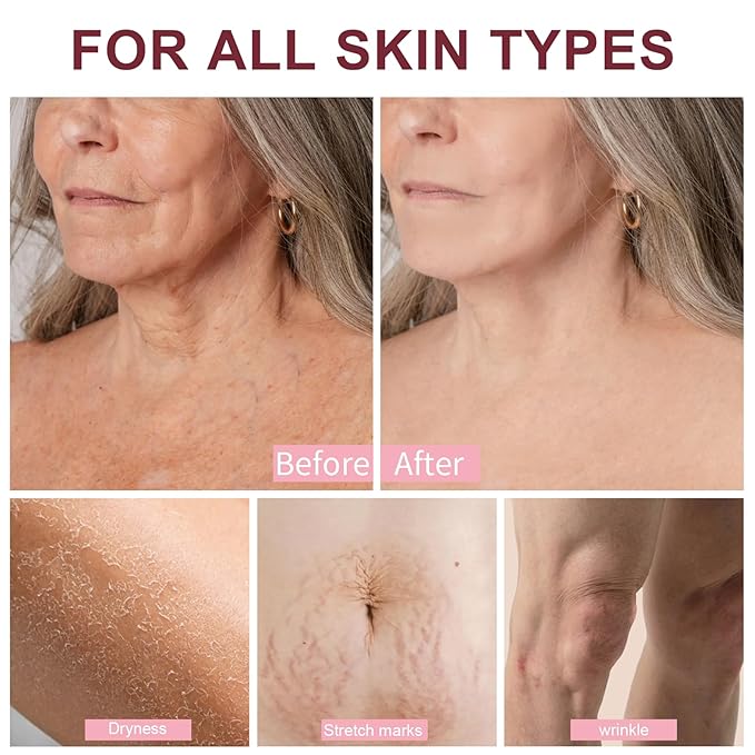 Mythic Body Oils for Women Skin Tightening Body Firming Oil Scented for Dry - Image 7