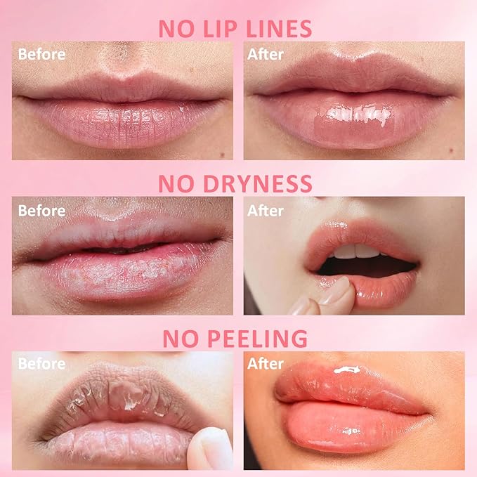 DMSKY 6 PCS Bee Lip Balm Honey Pot, Propolis Lip Mask Overnight Moisturizing - Image 4