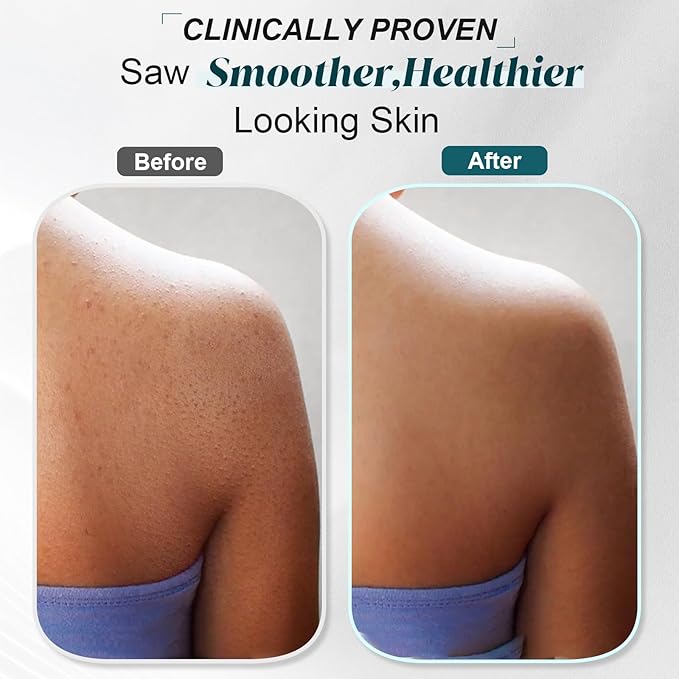 【Sea Salt Exfoliating Body Scrub & Wash】– Removes Dead Skin, Smoothes Rough - Image 5