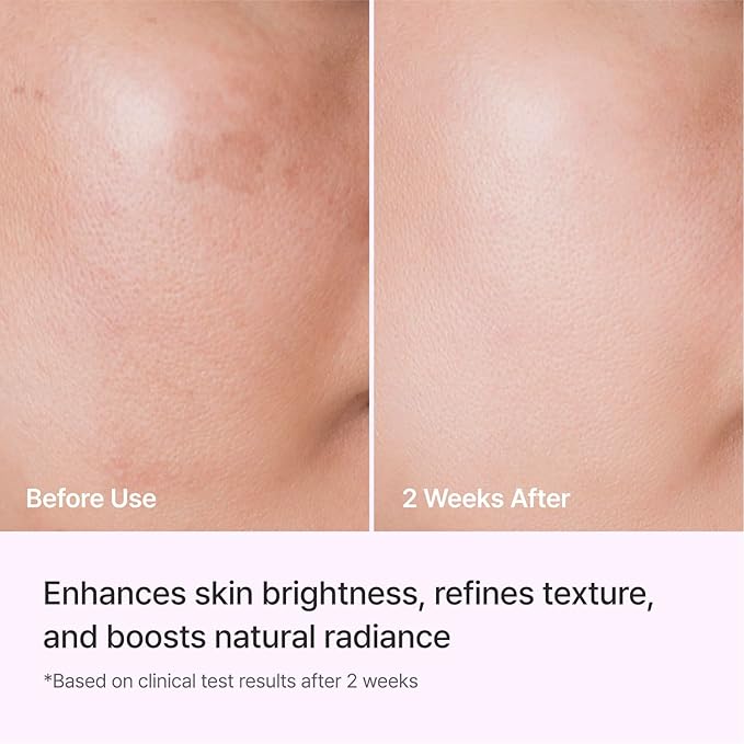 REJURAN® Triple Radiance Ampoule 50ml – DOT™ c-PDRN 0.5% Serum - Image 5