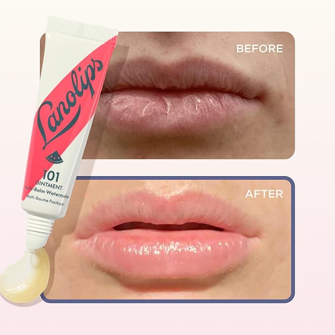 Lanolin 101 Multipurpose Ointment - Image 6