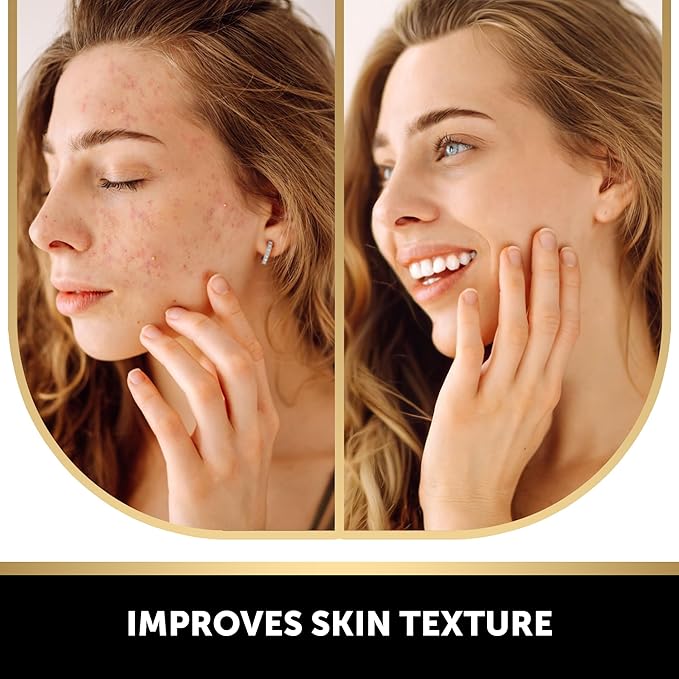VALITIC 4 Pack Kojic Acid Vitamin C & Retinol Soap Bars - Image 3
