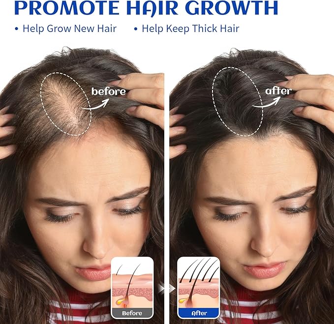 HIQILI 1000ML Rosemary Oil for Hair Growth, Add to Shampoo & Conditioner - Image 2