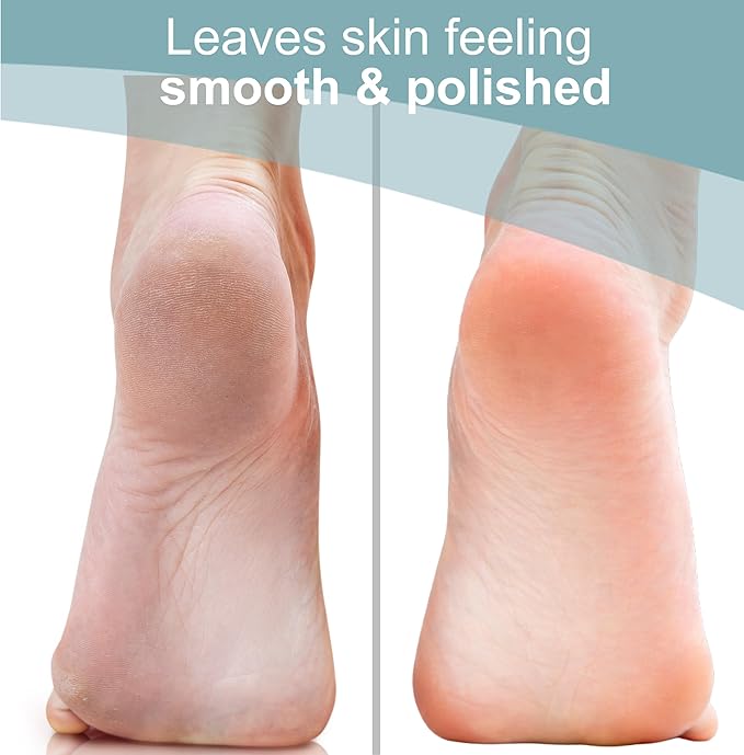 Trim Neat Feet Foot Care Implements Nano Glass Foot File, Hard Skin Remover - Image 7