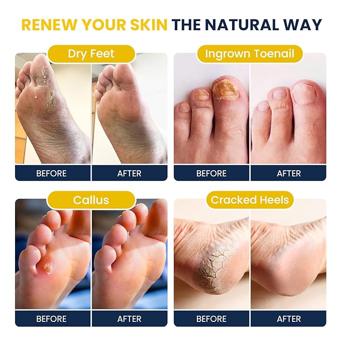 FOOT CURE Citrus Detox Foot Soak - Image 4