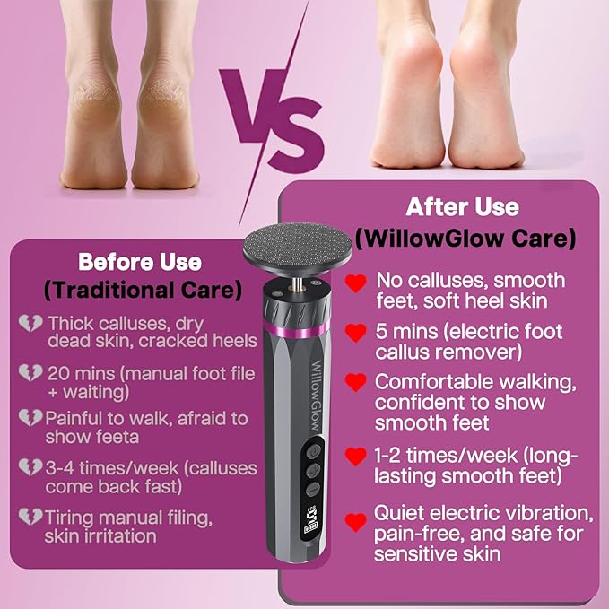 Professional Electric Foot Callus Remover, 9-Speed Cordless Foot File - Image 4