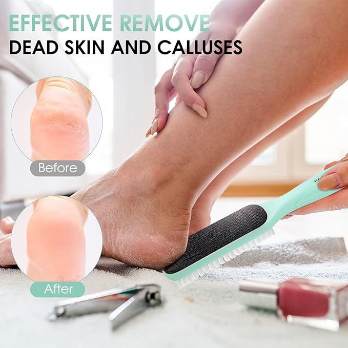 Foot File Callus Remover - Image 4