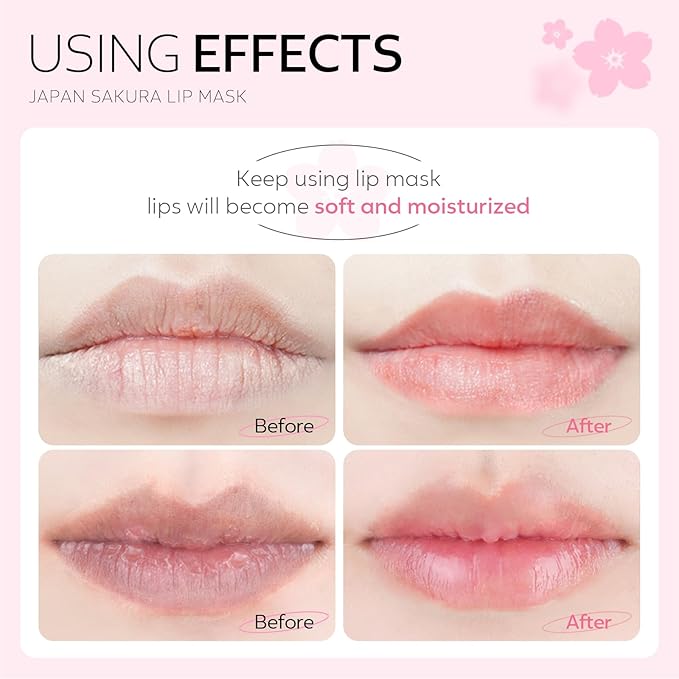 AKARY Sakura 5 Pieces Hydrating Lip Mask, Lip Sleep Mask Collagen Crystal Lip - Image 8