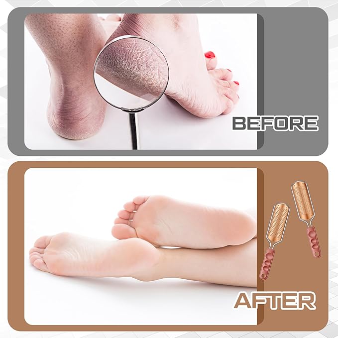 Moxweyeni 14 Pack Colossal Foot File Pedicure Tool Set - Image 5
