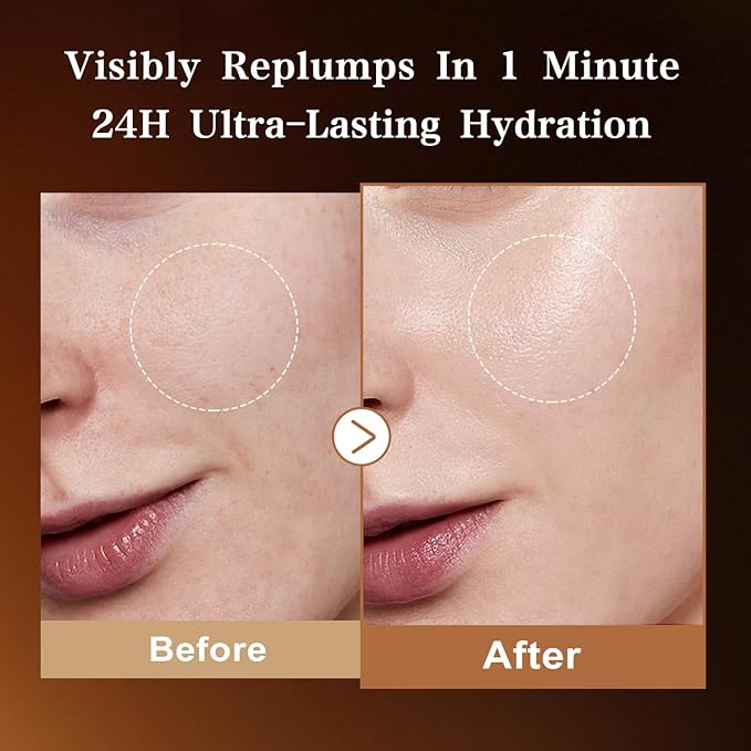 Ultra Hyaluronic Acid Serum - Image 4