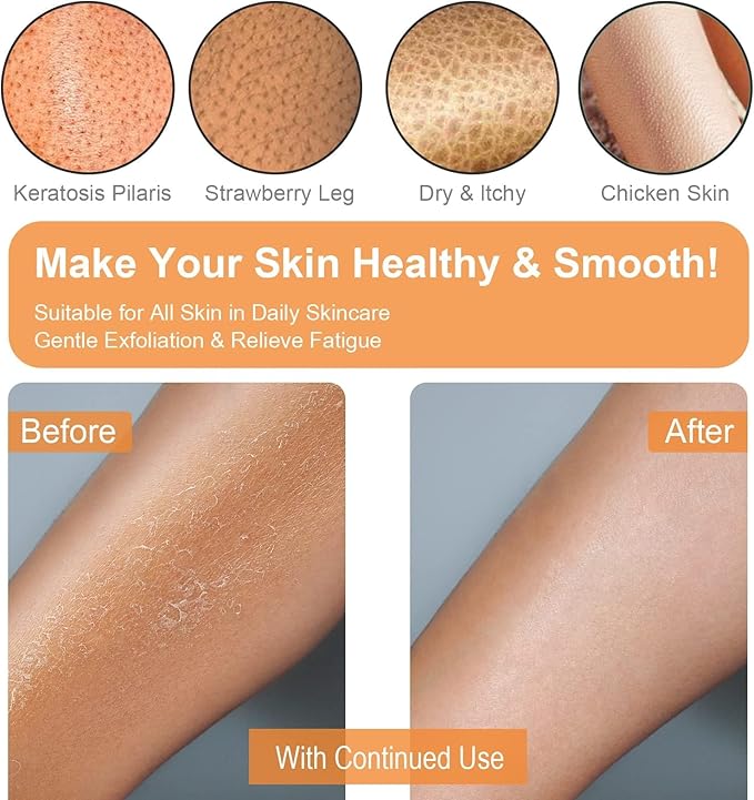Exfoliating Gloves 2 Pcs, Exfoliating Body Scrubber - Image 3