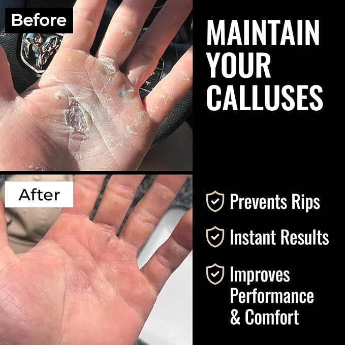 SandBar Ultimate Callus Remover Set - Image 2