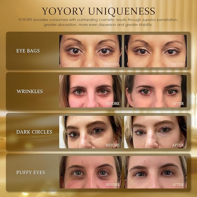 Under Eye Patches Masks - Image 2