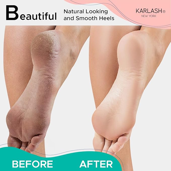 Karlash Professional Pedicure Foot Pumice Stone - Image 5