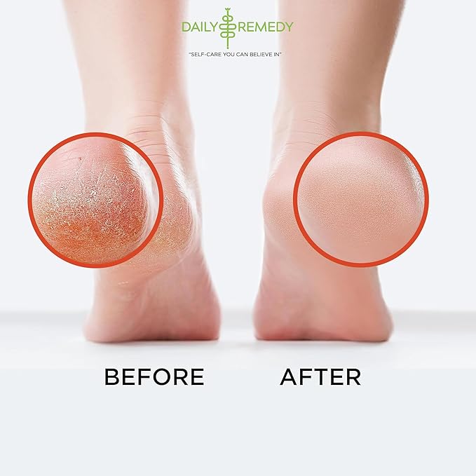 Muscle Relief Foot Soak with Epsom Salt, Made in USA, Soothe Tired Feet - Image 5