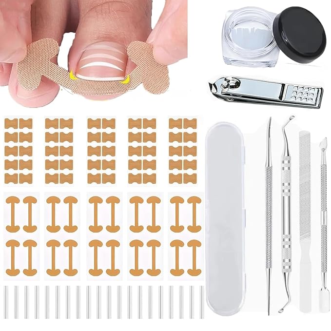 Ingrown Toenail Corrector Set by Unknown