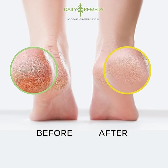 DAILY REMEDY 4-Pack Foot Soak Set - Image 5