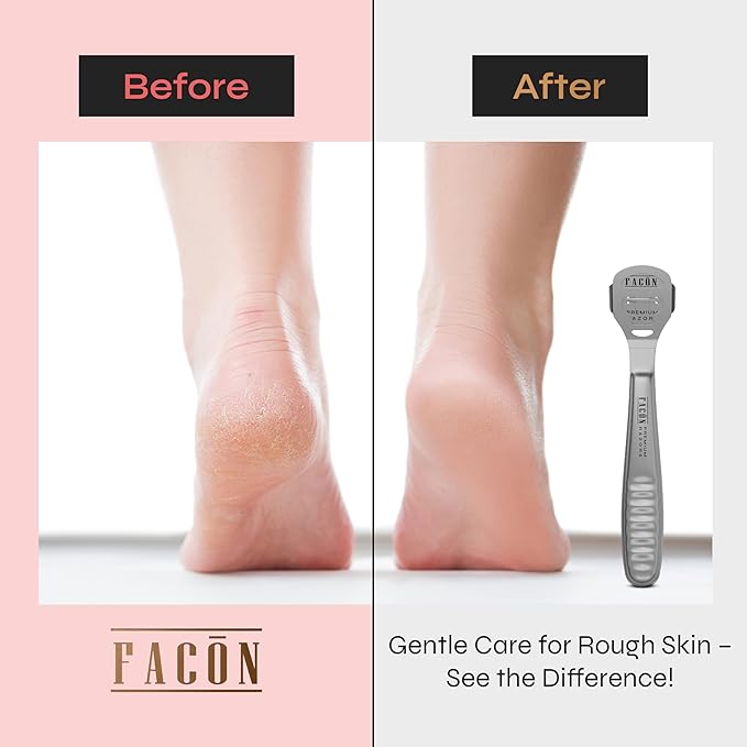 Facón Professional Callus Shaver Remover - Image 3