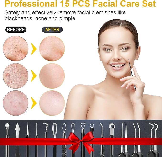 Pimple Popper Tool Kit, IUMAKEVP 15 PCS Professional Stainless Steel Blackhead - Image 5