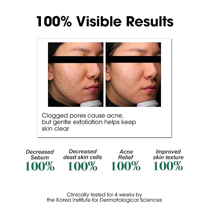 SOME BY MI AHA BHA PHA 30 Days Miracle Toner – 5.07oz, 150ml – Korean Salicylic - Image 4