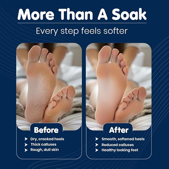 Imperial Feet Epsom Salt Foot Soak-Cracked Heels, Thick Calluses, Soften Hard - Image 4