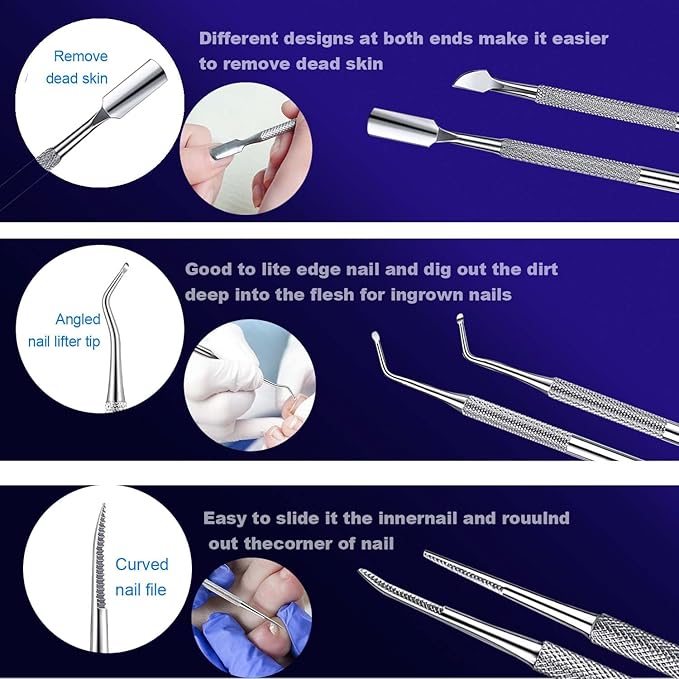 Ingrown Toenail File and Lifters Set, Ingrown Toenail Treatment Pedicure Kit - Image 3
