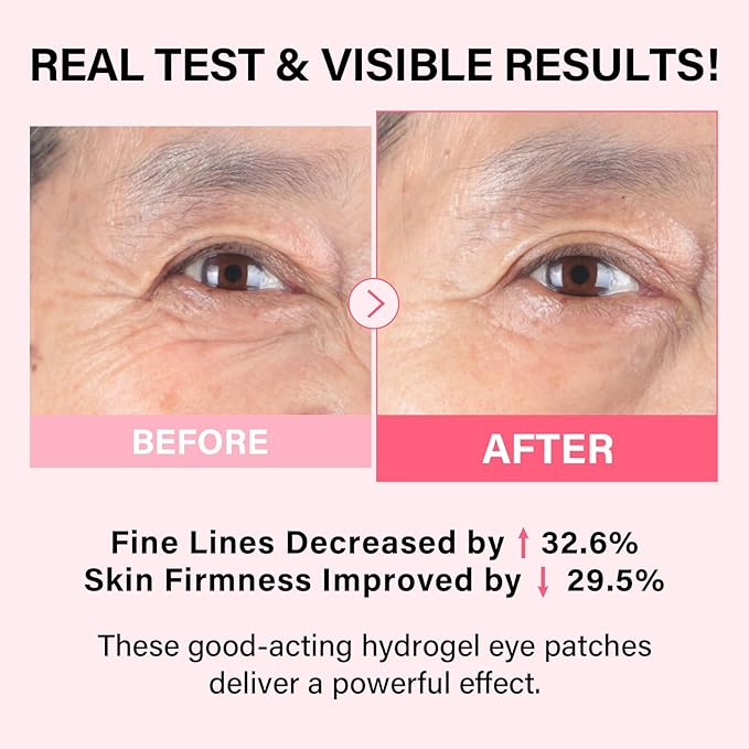 iMethod PDRN Collagen Boost Eye Patches - Image 2