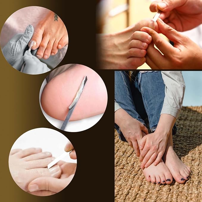 10-Pack Ingrown Toenail Tool, Toenail File and Lifters, Professional Surgical - Image 5