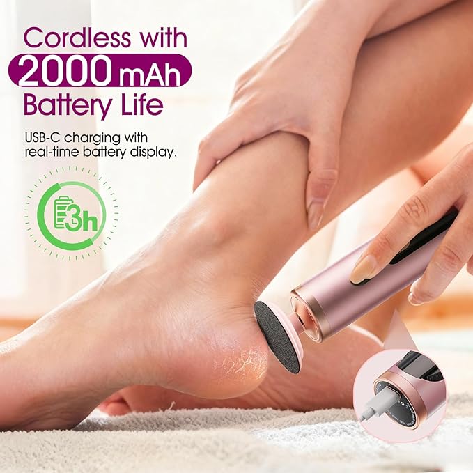 Electric Foot Callus Remover Rechargeable, Professional Pedicure Tools - Image 4
