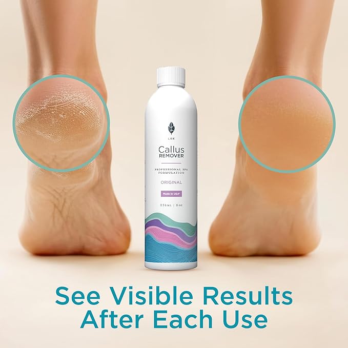 Lee Beauty 8oz Professional Gel Callus Remover - Image 4