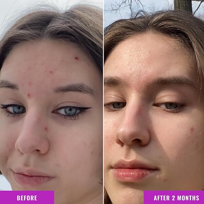 Good Molecules Niacinamide Serum - Image 4