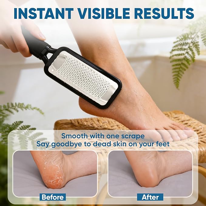 TEAWOO Foot File Callus Remover, Large Stainless Steel Foot Rasp, Heavy Duty - Image 6