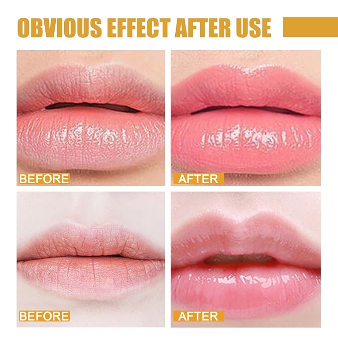 2 Pcs Lip Balm Honey Pot, Honey Moisturizing Lip Mask Reduces Lip Lines and - Image 5