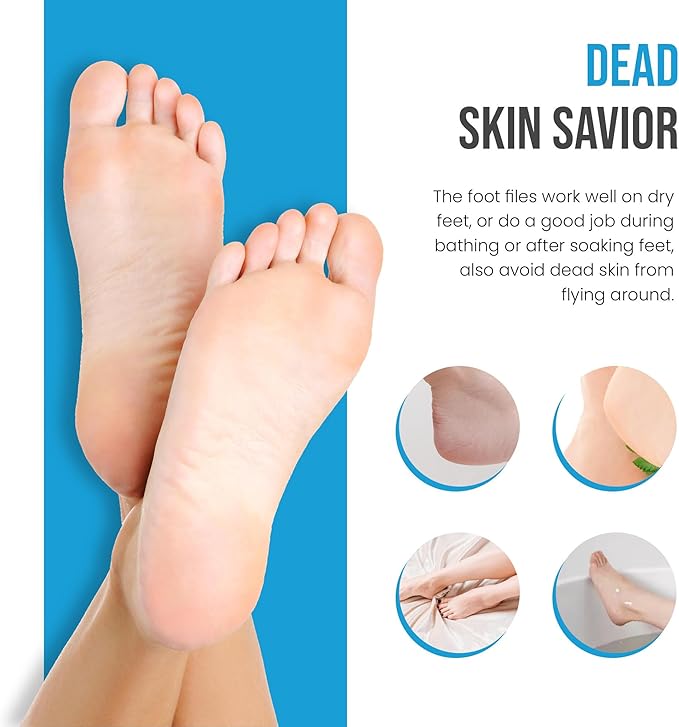 Foot Rasp Foot File Callus Remover Professional 7” Corn Removers - Image 5