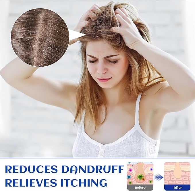 HIQILI 1000ML Rosemary Oil for Hair Growth, Add to Shampoo & Conditioner - Image 4