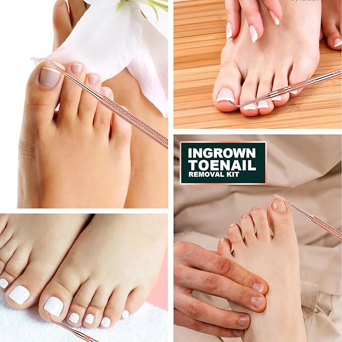Teenitor Pedicure Tools for Feet, Toenail File and Lifters, Ingrown Toenail - Image 7