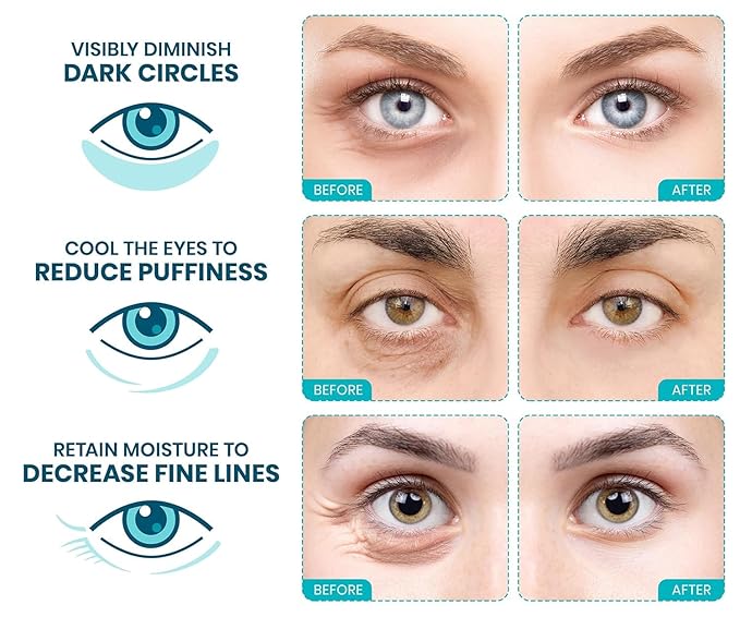 Stylia Collagen & Vitamin C Under Eye Patches - Image 5