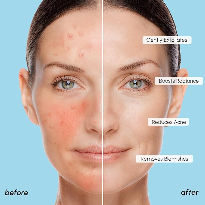 MAREE Glycolic Acid Pads - Image 5