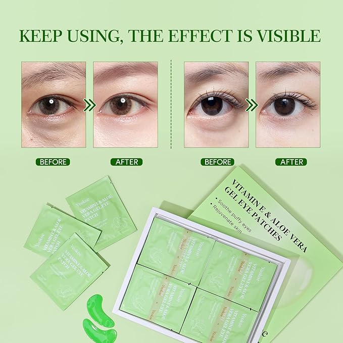 Yeokoe Under Eye Patches for Dark Circles, Puffy Eyes, 20 Pairs Face Masks - Image 4