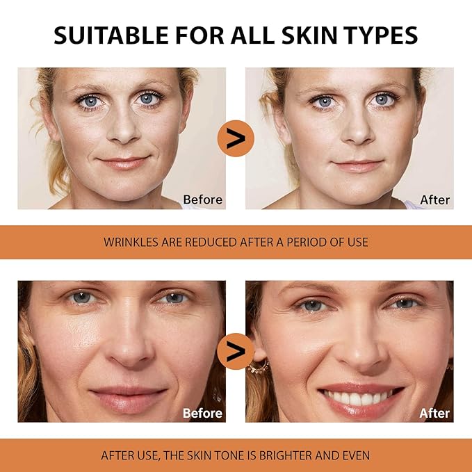 VGO Vitamin C Serum for Face, Vit C Anti Aging Serum - Image 7