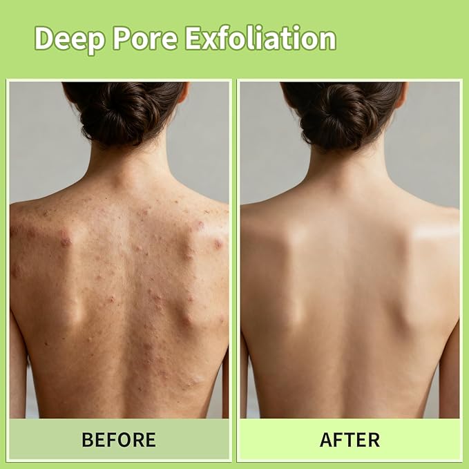 Korean Exfoliating Mitt & Glove Set, Smooth Skin and Spa-Like Experience - Image 5