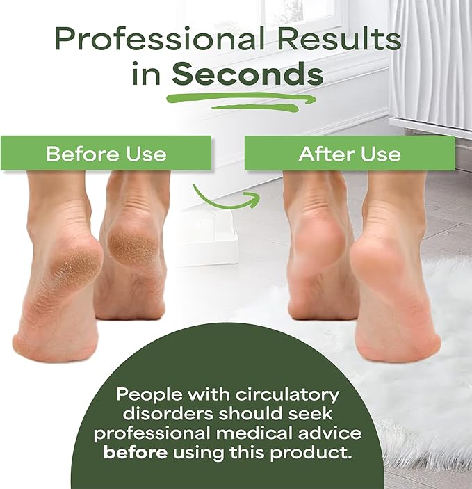 Professional Foot Scrubber Foot File - Image 5