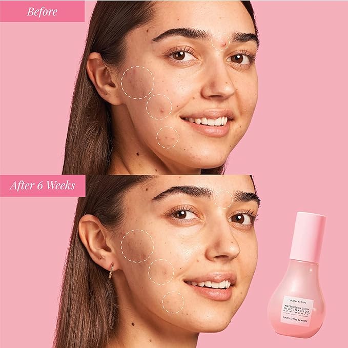 Glow Recipe Watermelon Niacinamide Dew Drops, Travel Size, Korean Niacinamide - Image 6