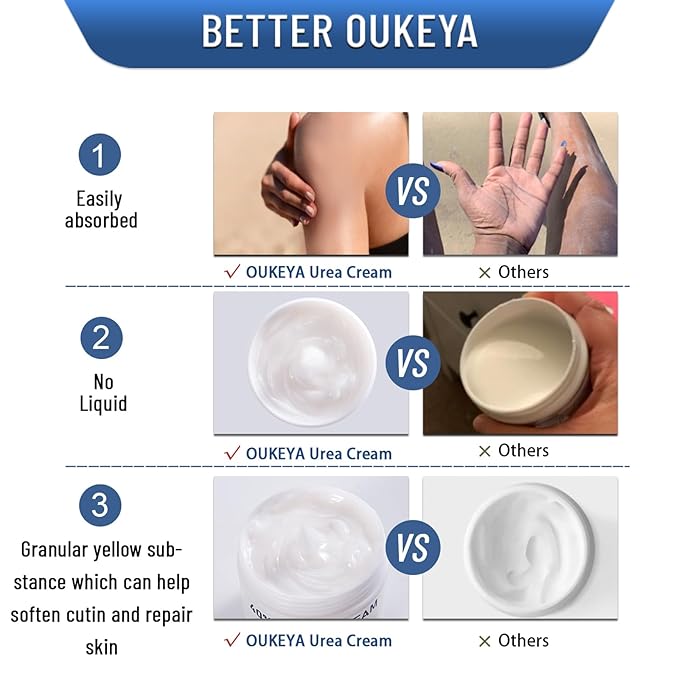 OUKEYA Urea Cream 40 Percent, Foot & Hand Cream - Image 6