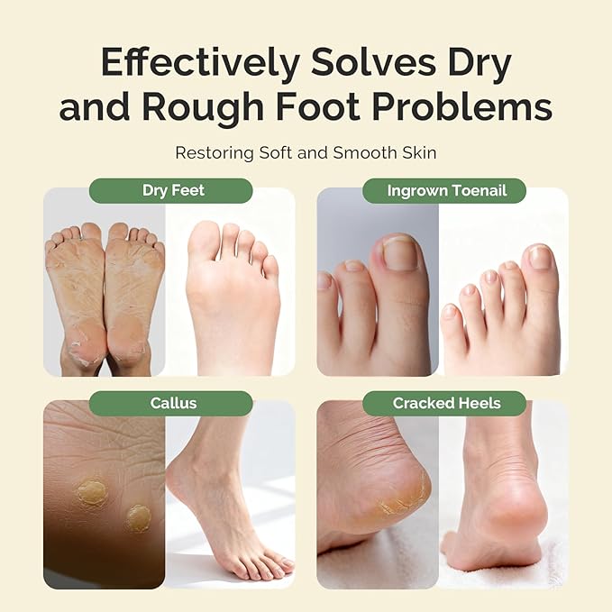 MelodySusie Tea Tree Oil Foot Soak - Image 2
