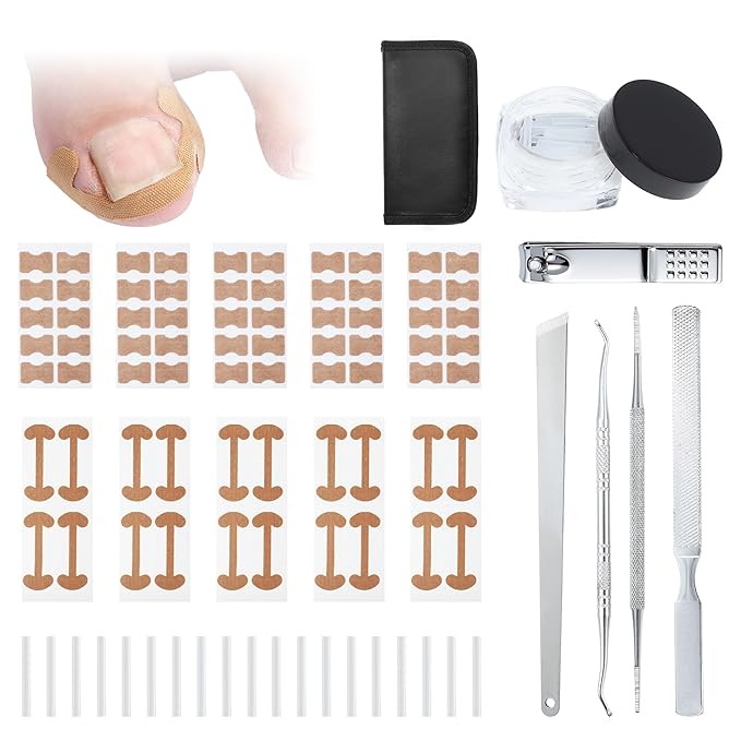 VOCOSTE Ingrown Toenail Correction Kit, Toe Nail Corrector Tools by VOCOSTE