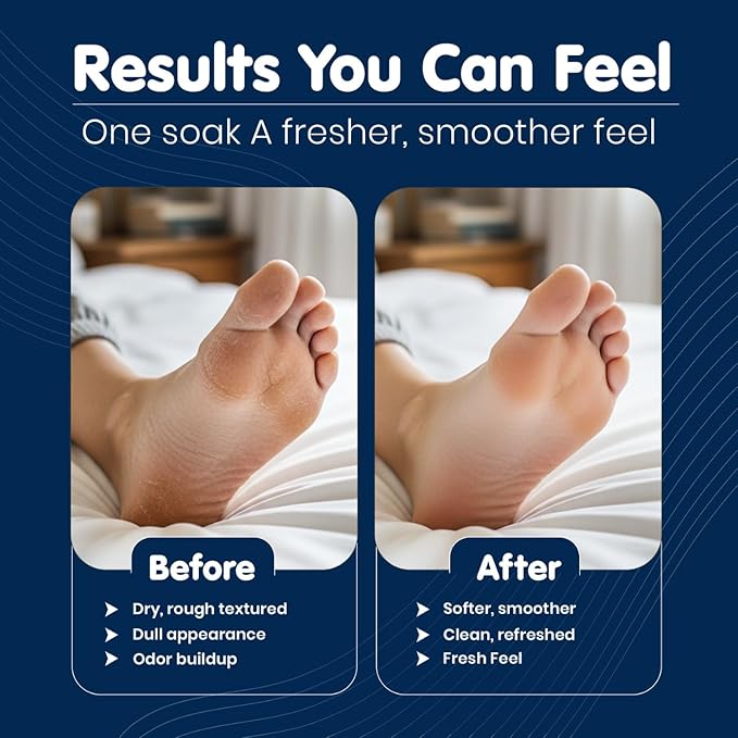 Imperial Feet Epsom Salt Foot Soak-Relaxing Wellness Detox Foot Soak - Image 6